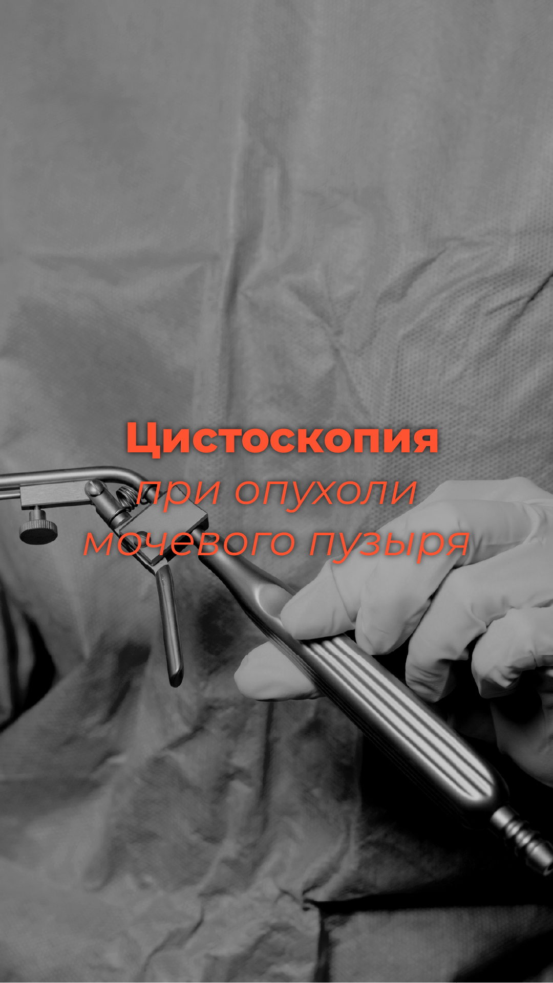 Цистоскопия